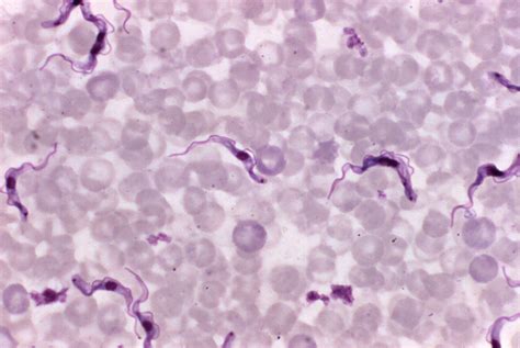 Trypanosoma Brucei Protozoan Responsible For Sleeping Sickness Among