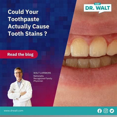 Could Your Toothpaste Actually Cause Tooth Stains Dr Walt Larimore