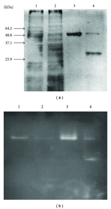 SDS PAGE A And Zymography B On A 15 Polyacrylamide Gel Of