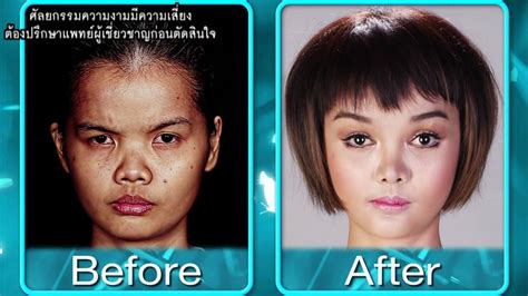 Photos Korean Surgery Show Gives Thai Girl ‘barbie Transformation
