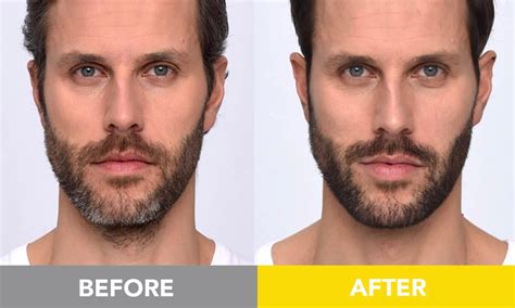 Customized Beard Dye And Beard Coloring For Men Cleverman