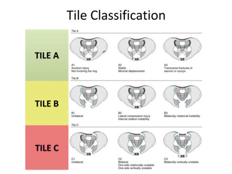 Opening the Book: Pelvic Trauma in the ED - EMOttawa