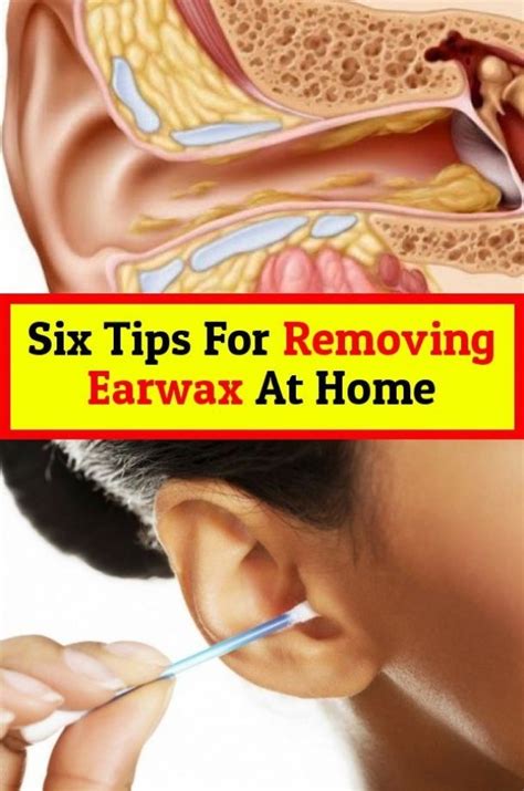 Here Are Six Tips To Remove Earwax In 2020 Ear Wax Natural Lubricant