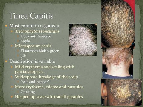 Ppt Disorders Of Pigmentation Powerpoint Presentation Id715908