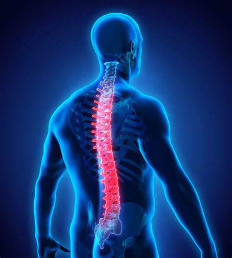 What Is The Recovery Time Post Fractured Vertebrae With No Spinal Cord