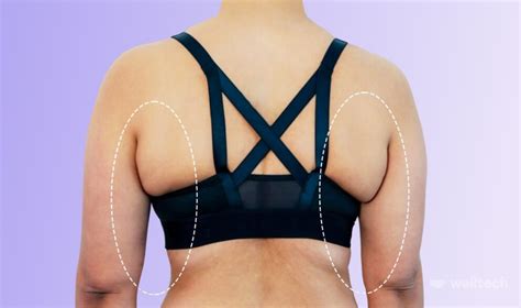 6 Bra Back Fat Exercises To Minimize Bra Bulge Welltech