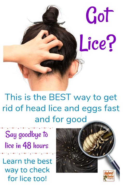 Coconut Oil For Lice Hybrid Rasta Mama