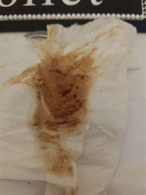 Brown Discharge With Tissue Like Pieces