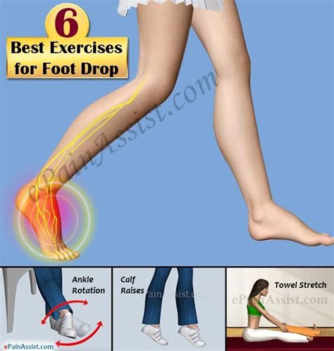 6 Best Exercises For Foot Drop Foot Drop Exercises Multiple