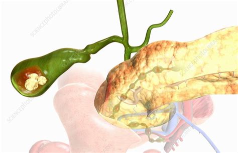 Gallbladder Stock Image C0079475 Science Photo Library