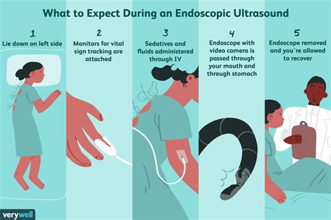 Endoscopic Ultrasound Uses Side Effects And Results