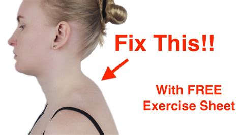 Easy Fix For The Neck Hump With Free Exercise Sheet Youtube