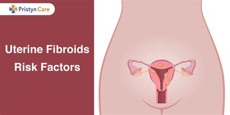 Uterine Fibroids Risk Factors Pristyn Care