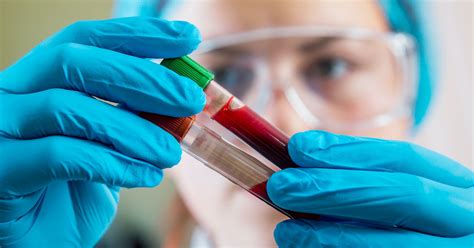 Promising Blood Test Detects Cancer In Study Of 5461 Patients From