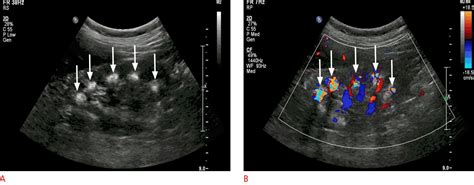 Ultrasonography