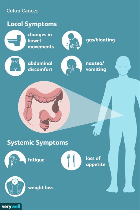 Colon Cancer Signs Symptoms And Complications
