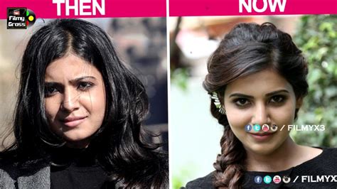 Top Tollywood Actress Before And After Plastic Surgery