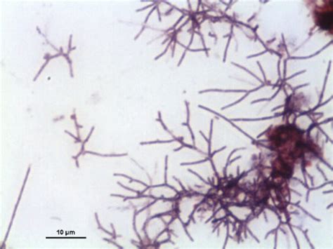 Common Wastewater Filaments Foaming And Bulking Bacteria Aquafix