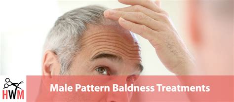 9 Most Effective Male Pattern Baldness Treatments Hair World Magazine