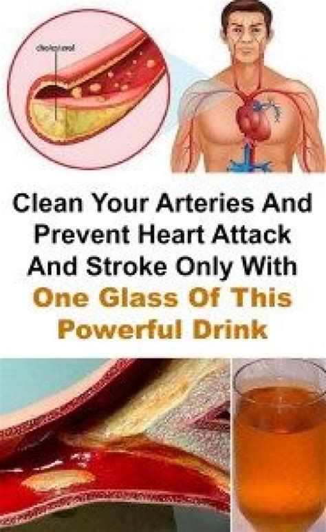 clean your arteries and prevent heart attack and stroke only with one