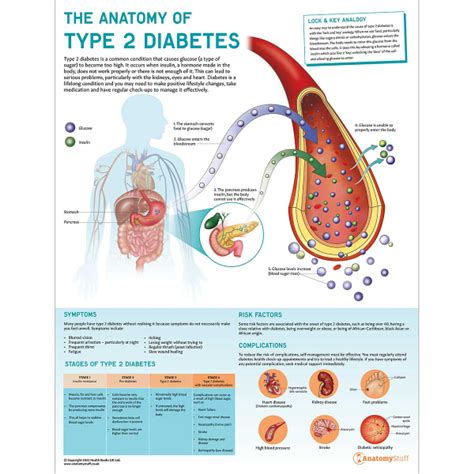 Understanding Type 2 Diabetes Anatomical Chart By Ana