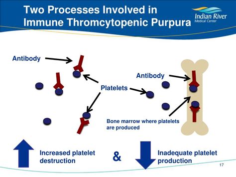 Ppt Immune Thrombocytopenic Purpura Powerpoint Presentation Free