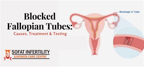 What Causes Blockage In The Fallopian Tubes How Can It Be Tested And