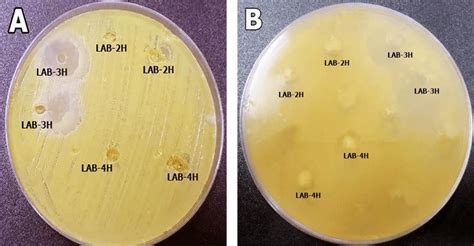 Antibacterial Activity Of Lactobacillus Strains LAB 2H LAB 3H And