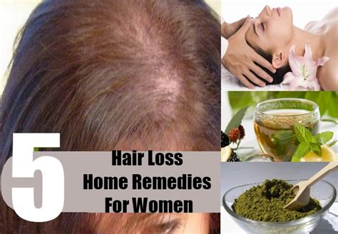5 Hair Loss Home Remedies Natural Treatments And Cure Herbal Supplements
