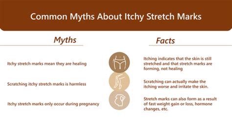 Why Do Stretch Marks Itch Causes And Proven Treatment Tips Evertone Skin