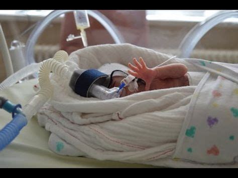 Meist lernen die babys zunächst ihren kopf kontrolliert zu bewegen, daraufhin meist das herumdrehen und danach schließlich das sitzen ohne hilfestellung. Wann dreht sich das baby ssw | Wichtig für die Geburt ...