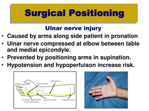 Ppt Surgical Positioning Powerpoint Presentation Free Download Id