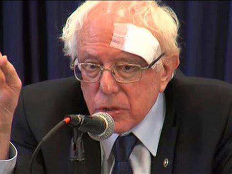Bernie Sanders Treated For Accidental Cut To Head While Campaigning