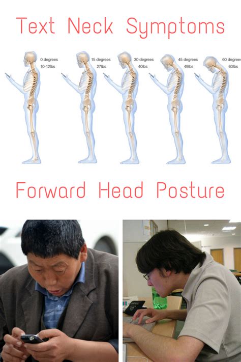 5 Steps To Fix Forward Head And Prevent Text Neck Symptoms