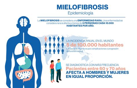 Mielofibrosis Conoce Novartis