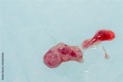 Dog Foetus Out Of Amniotic Sac Stock Photo Adobe Stock