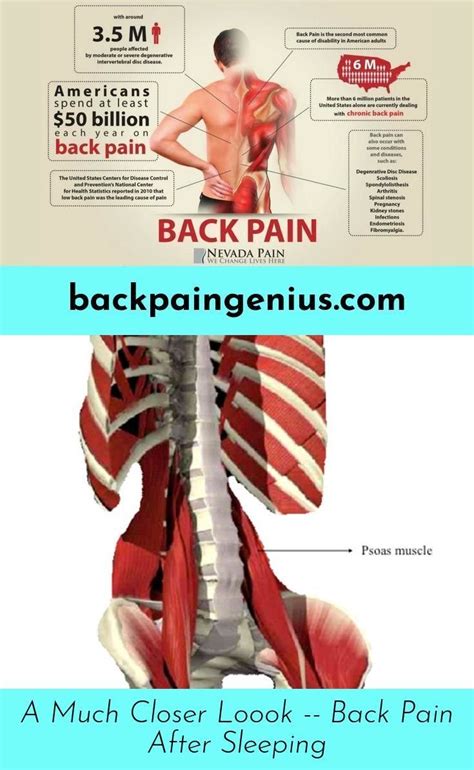 Kidney Stones Symptoms Back Pain Location Kidneyoi