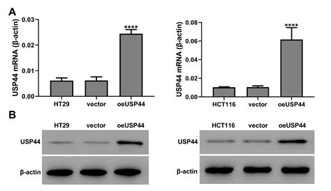 Usp Suppresses Proliferation And Enhances Apoptosis In Colorectal