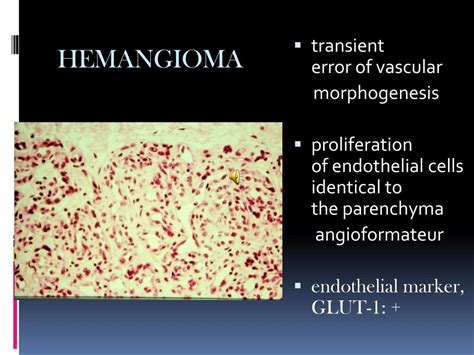Ppt Managment Of Vascular Malformations Powerpoint Presentation Free