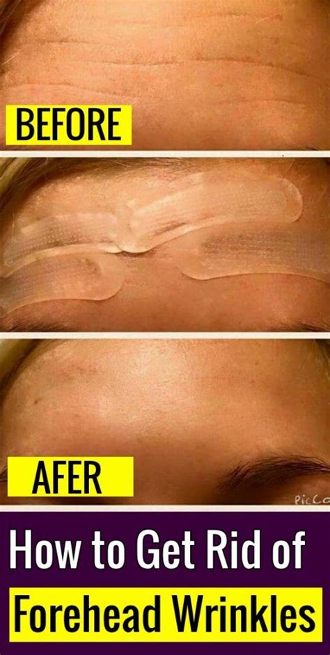 Best Home Remedies And Natural Tips To Remove Forehead Lines