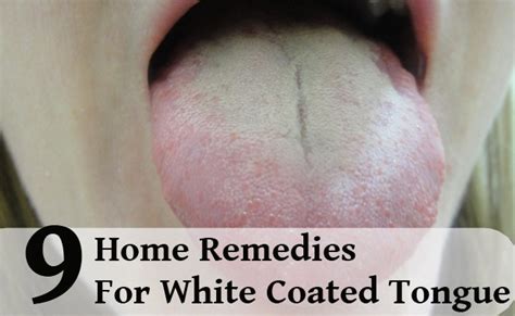 9 Easy Home Remedies For White Coated Tongue Lady Care Health