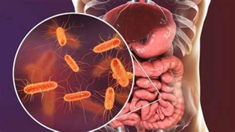 Artificial Sweeteners Are Toxic To Gut Bacteria Study Reveals Nexus