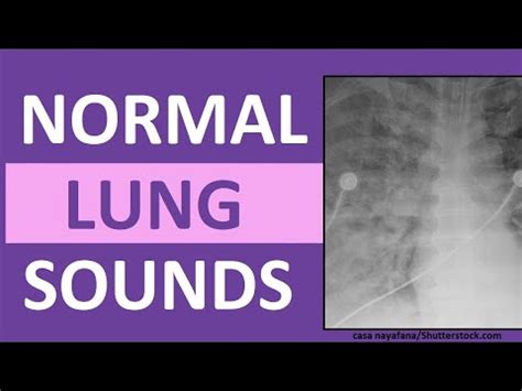 Indicate that tracheal sound may not be a sensitive. Lung Sounds (Normal) Bronchial Bronchovesicular Vesicular ...