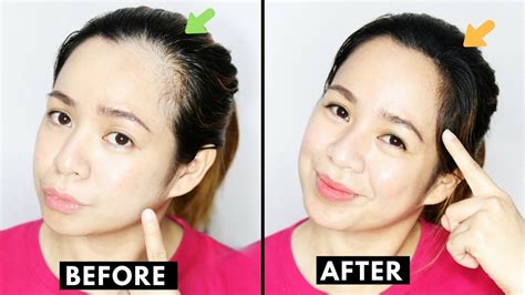 Best Photos How To Get Rid Of Baby Hairs On Hairline How To Fix Edge Up Your Own Hairline