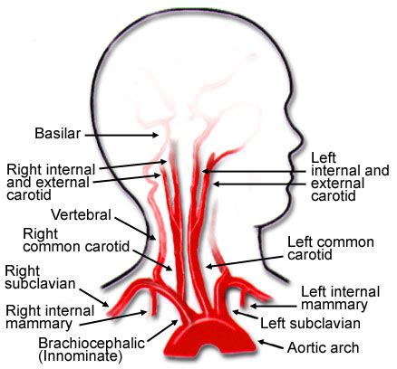 Branch of the brachiocephalic trunk course: Carotid Artery - CERVICAL SPINE PAIN