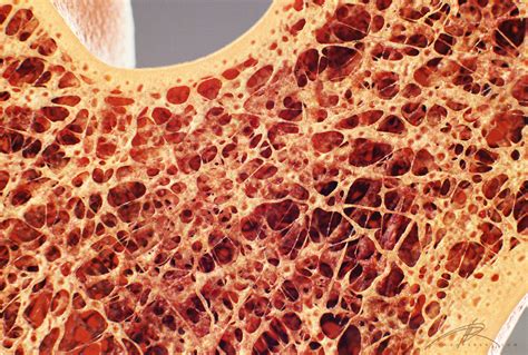 In a cross section of a bone we can see two types of bone tissue: "Bone Cross Section" for Radius Digital Science on Behance