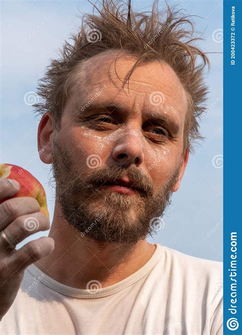 Man With Spotted Face Eating Apple Stock Photo Image Of Decorator