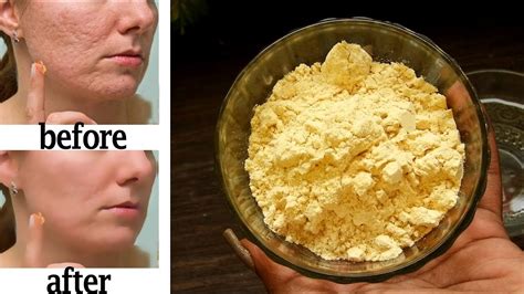 Everyday Besan Face Pack For Healthy And Glowing Skin Besan Sandalwood