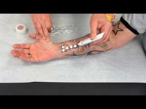 How to apply EMLA numbing cream for laser tattoo removal. http