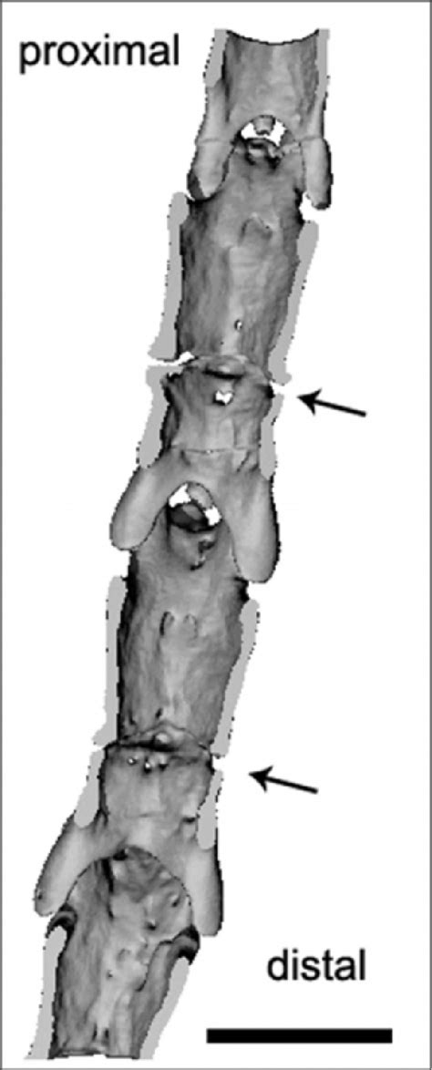 Figure 5 From Three Dimensional Evaluation Of Structures In Small Bones